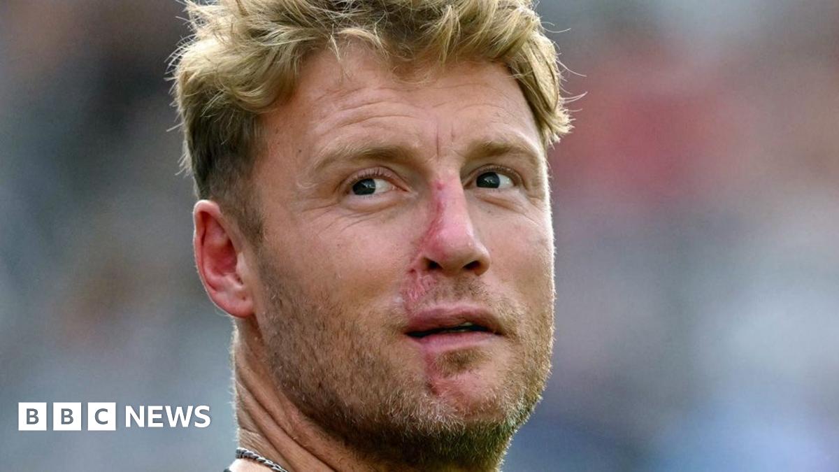 Andrew Flintoff Recovering After Horrific Top Gear Stunt Crash Andrew Flintoff Recovering After Horrific Top Gear Stunt Crash