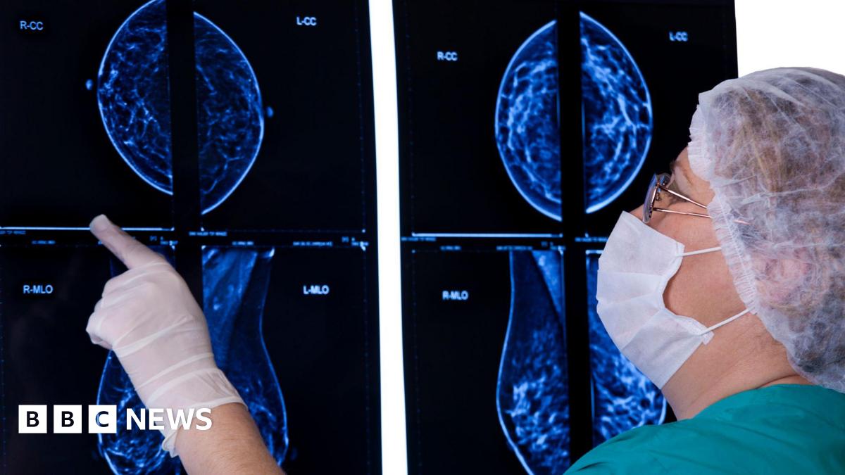 Clinical Trial Shows Significant Slowdown Of Incurable Breast Cancer With New Medication Clinical Trial Shows Significant Slowdown Of Incurable Breast Cancer With New Medication